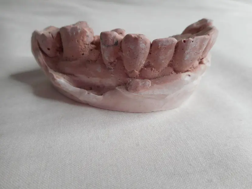 Vintage Cast Dental Teeth Mold Tooth Castings Medical Oddity #11