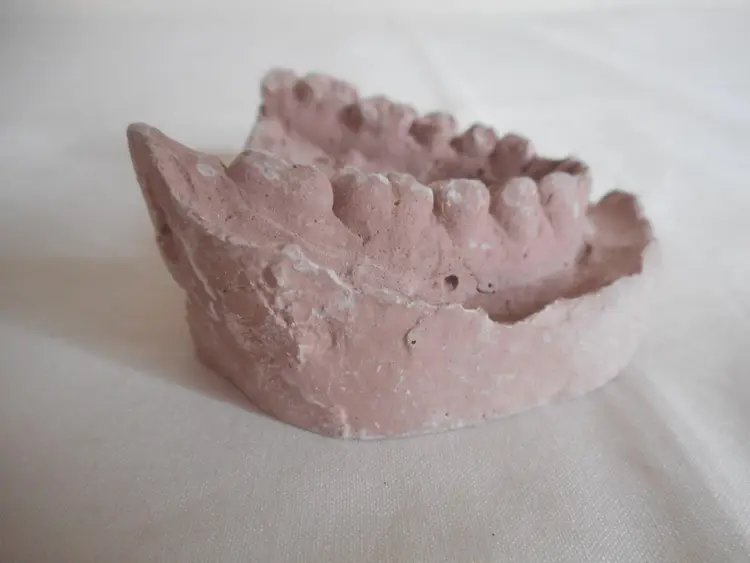 Vintage Cast Dental Teeth Mold Tooth Castings Medical Oddity #9