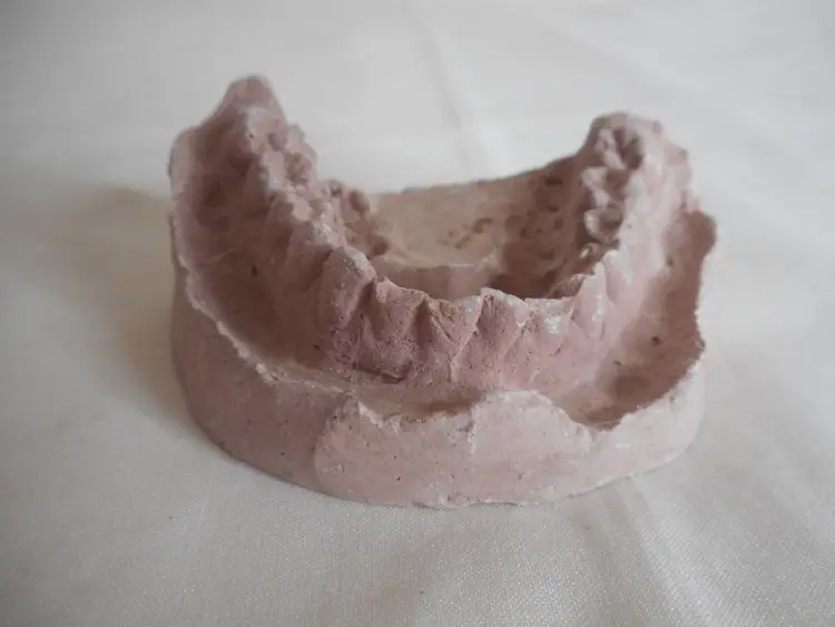 Vintage Cast Dental Teeth Mold Tooth Castings Medical Oddity #9