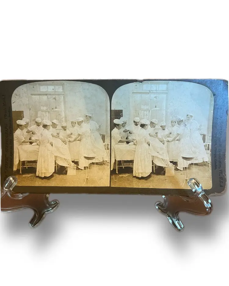 ANTIQUE 1905 SURGICAL LEG AMPUTATION STEREOVIEW PHOTO- Wounded Soldier