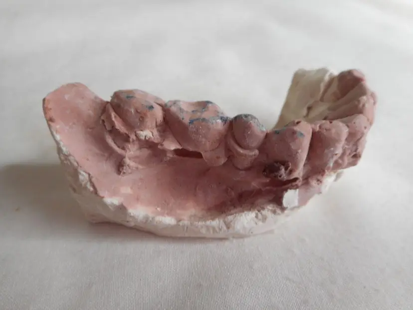Vintage Cast Dental Teeth Mold Tooth Castings Medical Oddity #12
