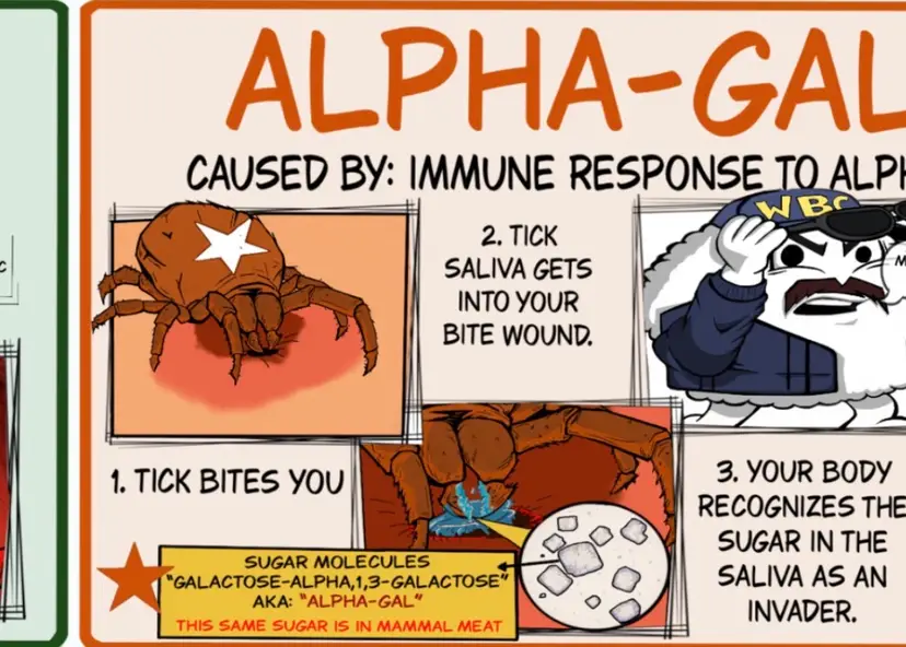 Tick Bite Poster | Lyme Disease, Alpha-Gal Syndrome Patient Education (Digital Download)